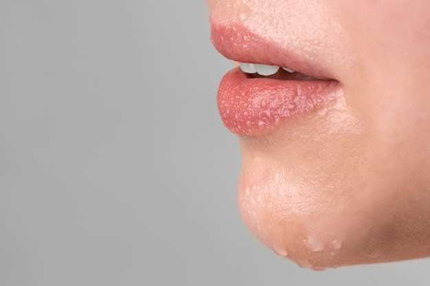 Герпес на губах: причины и симптомы