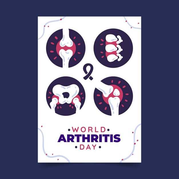 Профилактика артрита и артроза: физические упражнения и питание