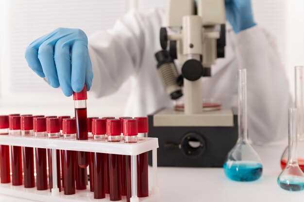 Основные показатели биохимического анализа крови из вены
