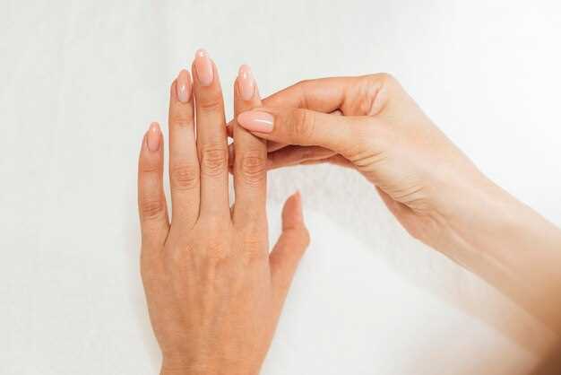 Причины расслаивания ногтей на руках