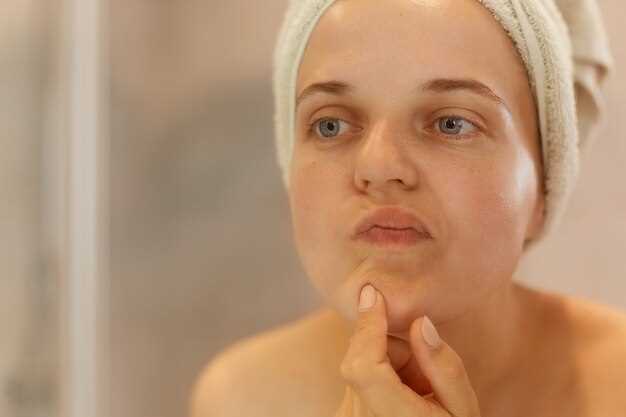 Сыпь на лице у взрослого женщины: причины и лечение