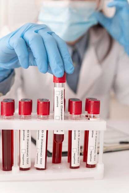 Последствия недостаточного объема крови для анализа