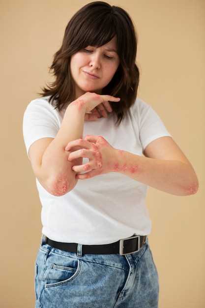 Профилактика и предупреждение появления жировика на руке